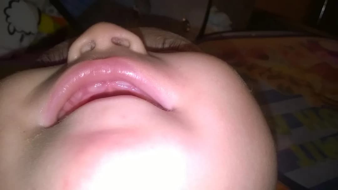 Górne jedynki ząbkowanie: jak wyglądają dziąsła u niemowlaka?