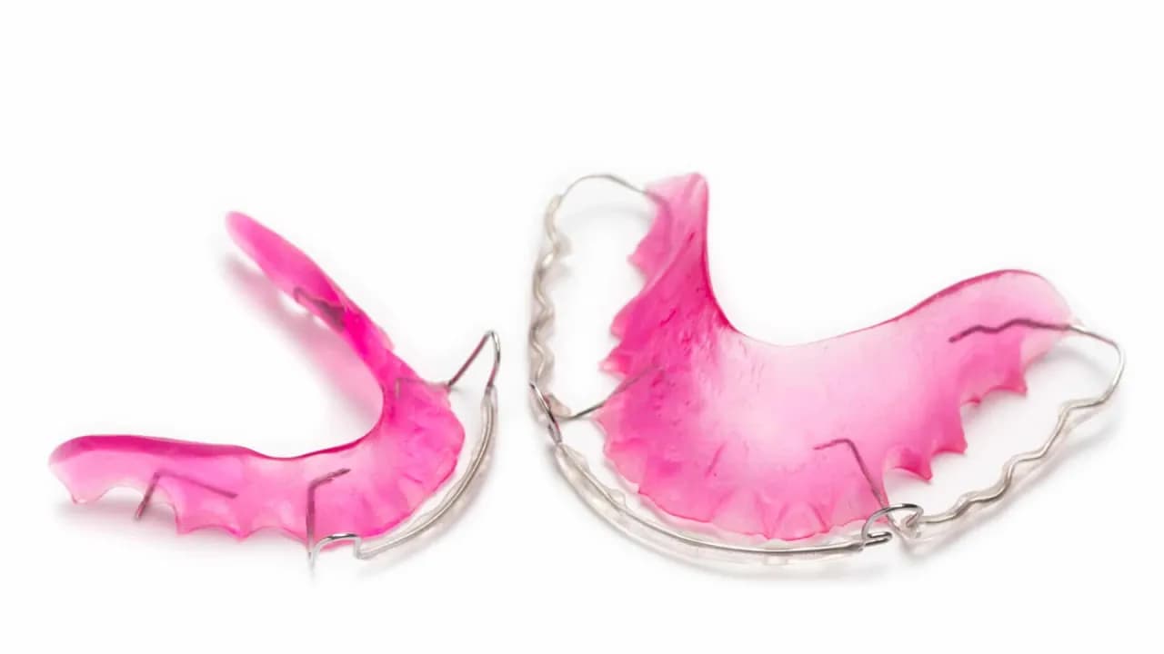 Czy aparat retencyjny wyprostuje zęby? Odkryj prawdę o retainerach