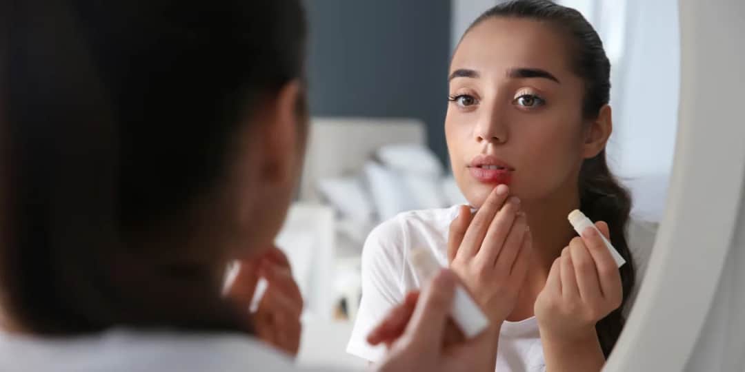 Czy można iść do dentysty z opryszczką? Ryzyko i zalecenia zdrowotne