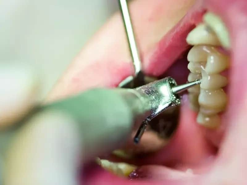 Czy dentysta może odmówić przyjęcia pacjenta z bólem zęba? Oto prawda