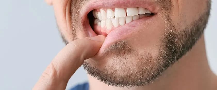 Jak skutecznie leczyć zapalenie dziąseł i uniknąć poważnych problemów