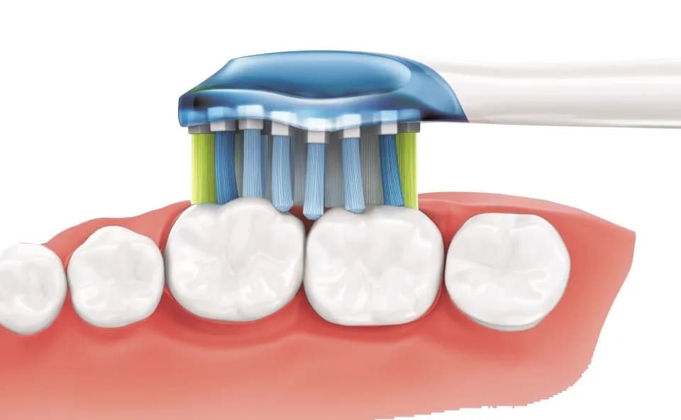 Co wzmacnia zęby i dziąsła? Poznaj skuteczne sposoby na zdrowie jamy ustnej