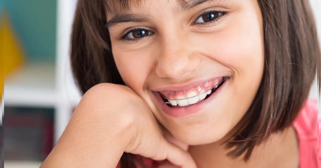 Jak wygląda aparat ruchomy na zęby dla dzieci – cechy i korzyści