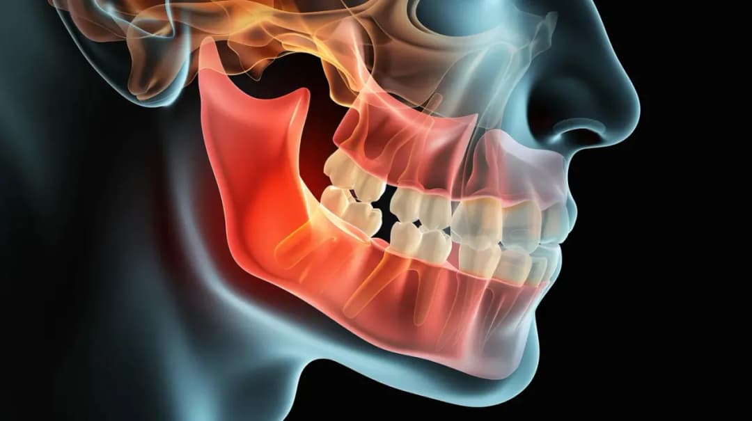 Rosnący ząb mądrości: skuteczne sposoby na uśmierzenie bólu