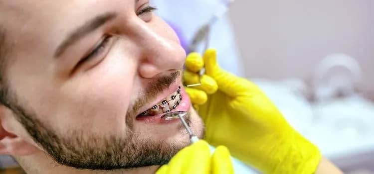 Czy zakładanie aparatu na zęby boli? Prawda o dyskomforcie i odczuciach