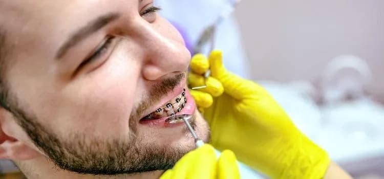 Czy zakładanie aparatu na zęby boli? Prawda o dyskomforcie i odczuciach