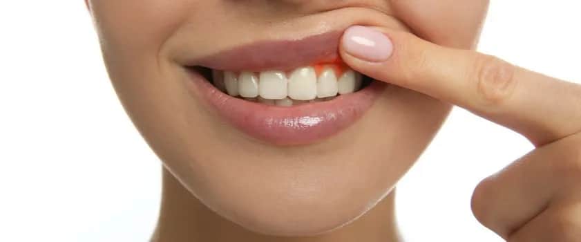 Co na bolące dziąsła w ciąży? Bezpieczne sposoby na ulgę i zdrowie