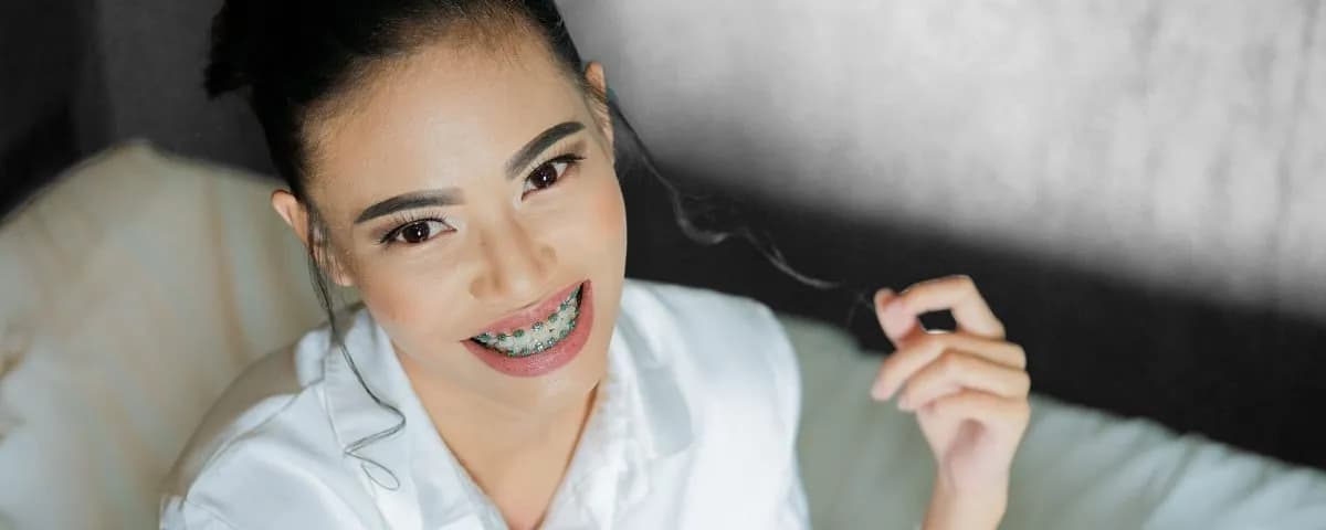 Na jakie zęby zakłada się aparat ortodontyczny i kiedy to robić?