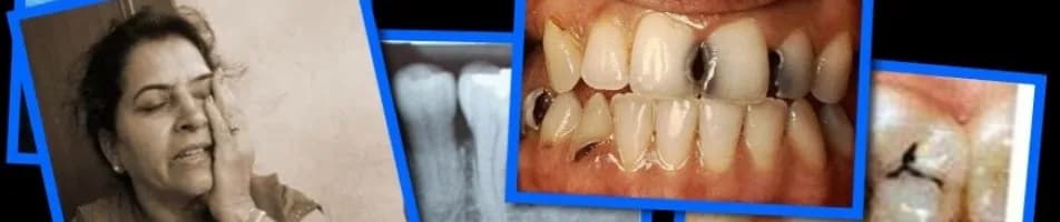 Czym smarować dziąsło po wyrwaniu zęba, aby uniknąć bólu?