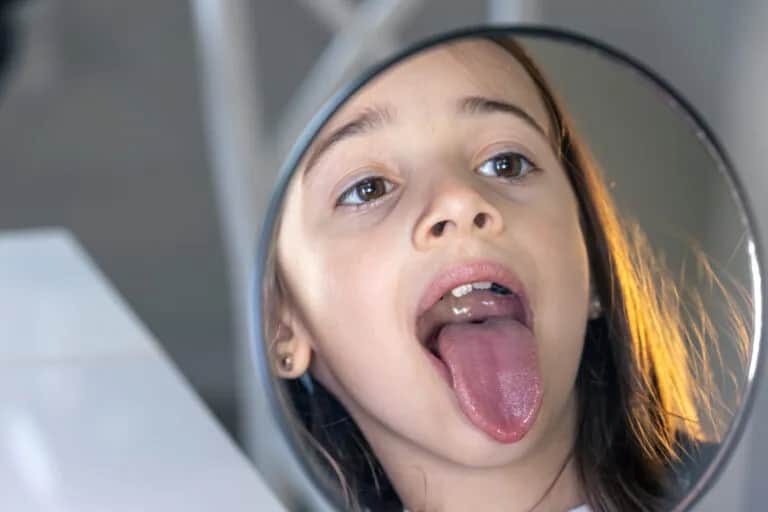 Jak wyrwać zęba mleczaka który się rusza bez bólu i stresu