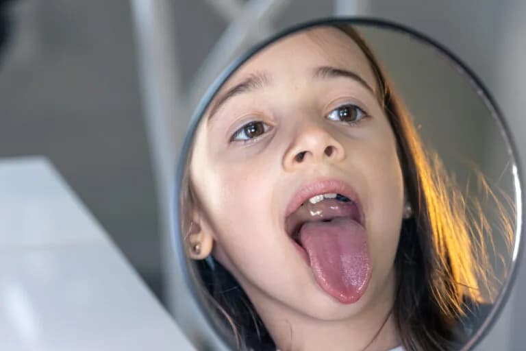 Jak wyrwać zęba mleczaka który się rusza bez bólu i stresu