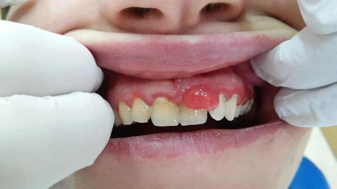 Jakiego lekarza wybrać przy chorobach błony śluzowej jamy ustnej?