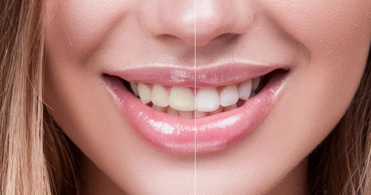 Skuteczne metody na wybielenie zębów w domu – uniknij problemów