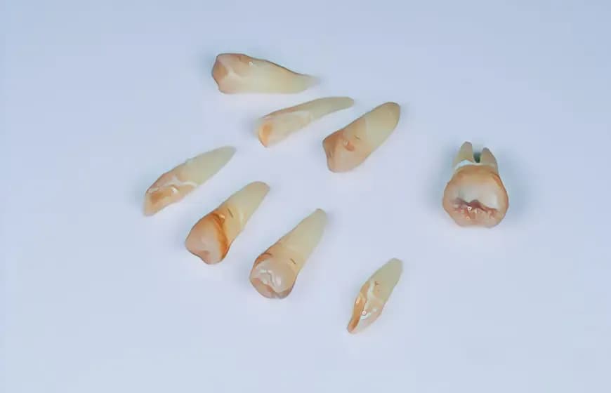 Objawy sepsy po wyrwaniu zęba – nie bagatelizuj tych sygnałów